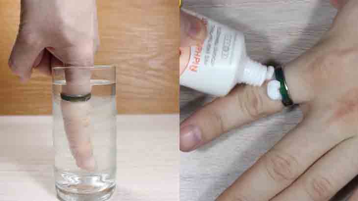 Снять кольцо при помощи крема или холодной воды